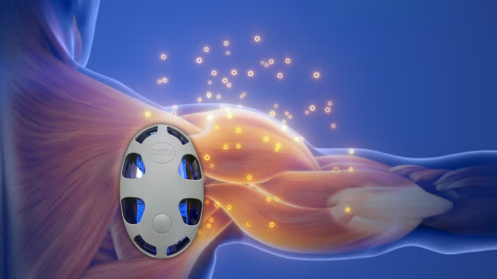 טיפול בדלקת מפרקים באמצעות Oska Pulse