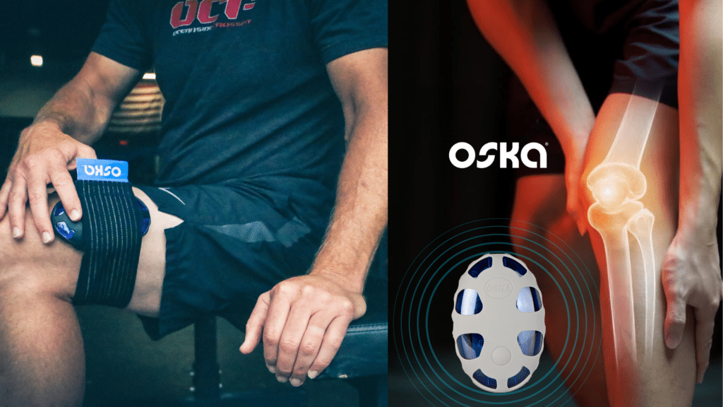 טיפול בדלקת ללא תרופות מכשיר Oska Pulse